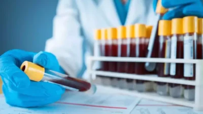 Rh null kan grubu, alyuvarlardaki 50’den fazla Rh antijeninin hiçbirini