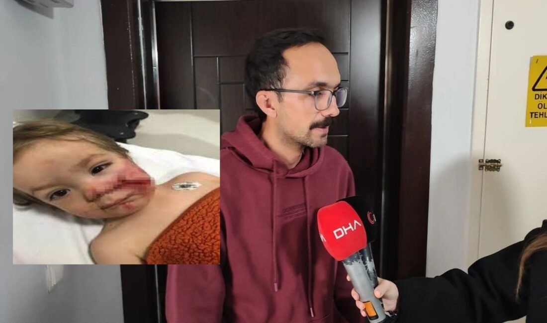 Ankara’nın Etimesgut ilçesi Atayurt Mahallesi’nde 2 kardeşe saldıran pitbull cinsi