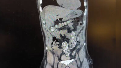 Fars’ta yaşayan Cüneyt Ç. (52), 2 gündür süren karın ağrısı