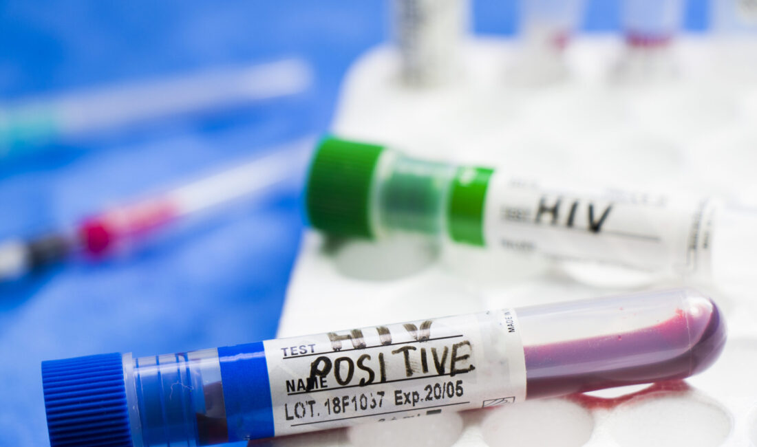 Doç. Dr. Şentürk, Dünya Sağlık Örgütü verilerine göre Amerika ve