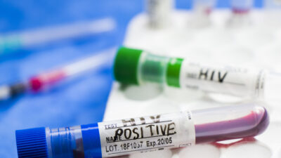 Doç. Dr. Şentürk, Dünya Sağlık Örgütü verilerine göre Amerika ve