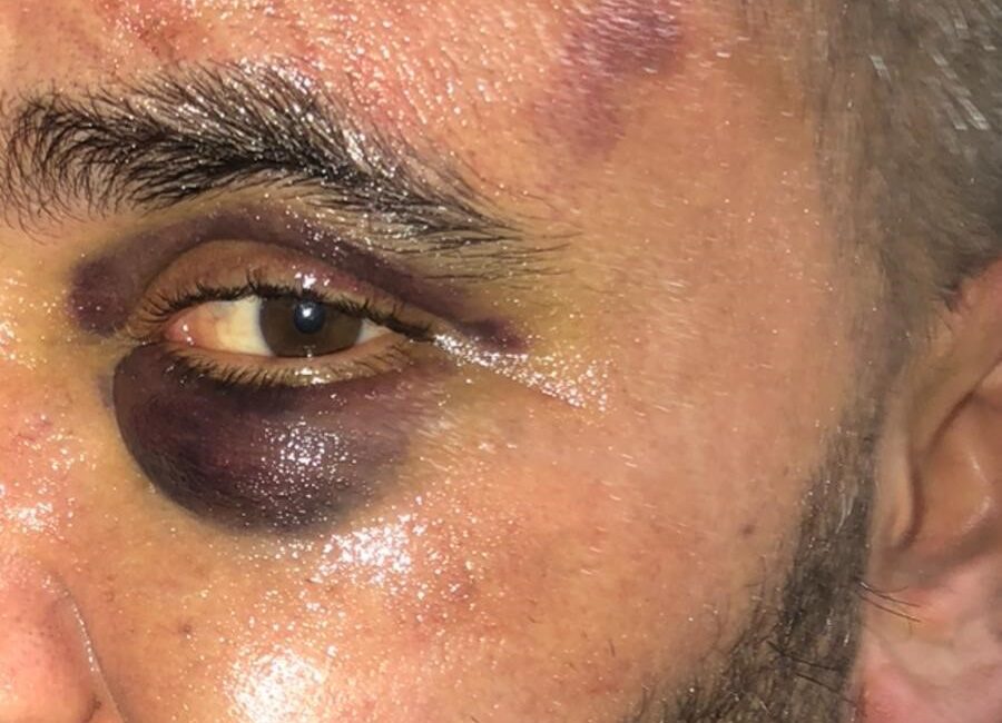 Afyonkarahisar’da bir restoran işletmecisi, dükkanını basan 3 şahıs tarafından feci