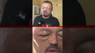 Adana’da yaşayan Murat Gözde (48), berber tavsiyesi üzerine internetten satın