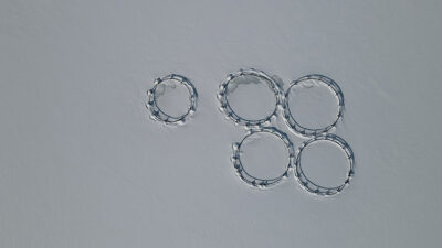 Kent genelinde 3 gün boyunca aralıklarla süren kar yağışı sonrası