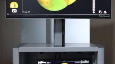 Türkiye’deki her 100 bebekten yaklaşık 12’si prematüre, yani vaktinden önce