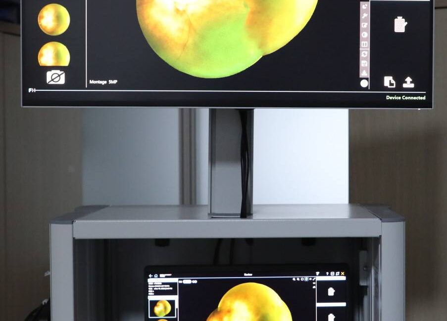 Türkiye’deki her 100 bebekten yaklaşık 12’si prematüre, yani vaktinden önce