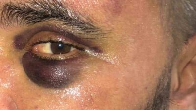 Afyonkarahisar’da dükkanını basan 3 kişi tarafından öldüresiye darp edilen iş