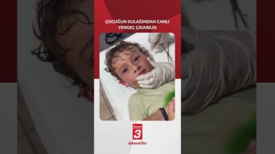 Meksika’da “kafamın içinde bir şey kıpırdıyor” diyen çocuğun kulağından yengeç