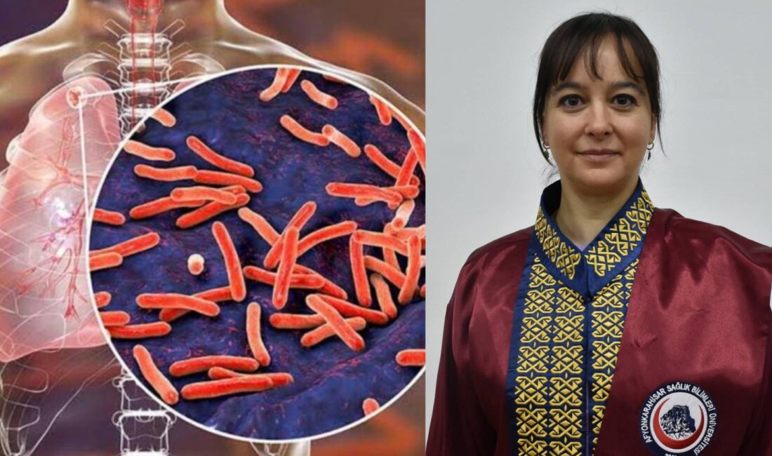 AFSÜ Tıp Fakültesi Göğüs Hastalıkları Ana Bilim Dalı Başkanı Doç.