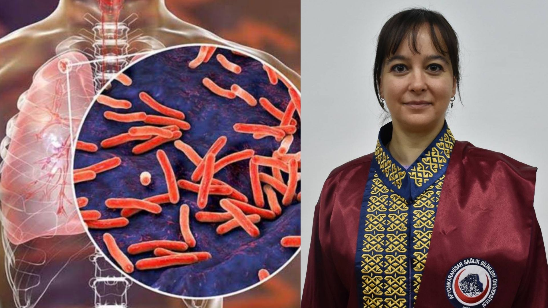 AFSÜ Tıp Fakültesi Göğüs Hastalıkları Ana Bilim Dalı Başkanı Doç.