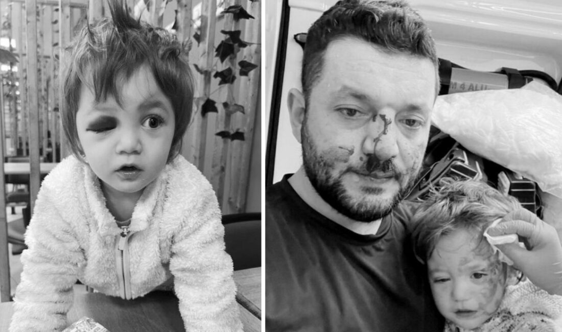 Yalova’da kucağındaki 14 aylık bebeğiyle birlikte acımasızca darp edilen Muhammet