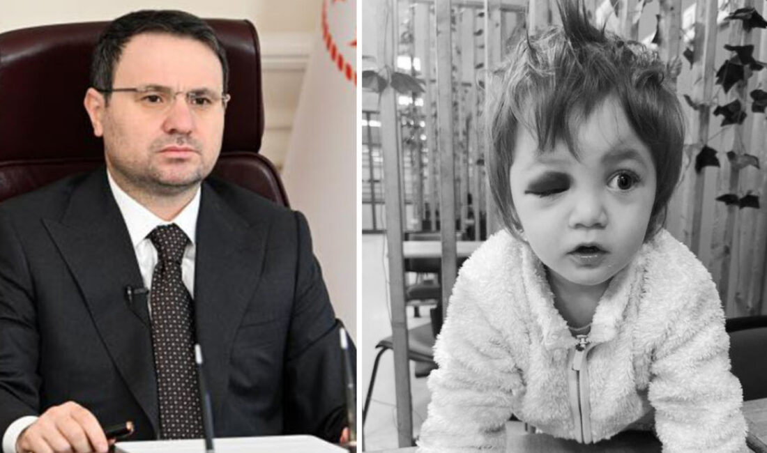 Yalova’da kucağındaki bebeğiyle birlikte saldırıya uğrayan baba ve 14 aylık