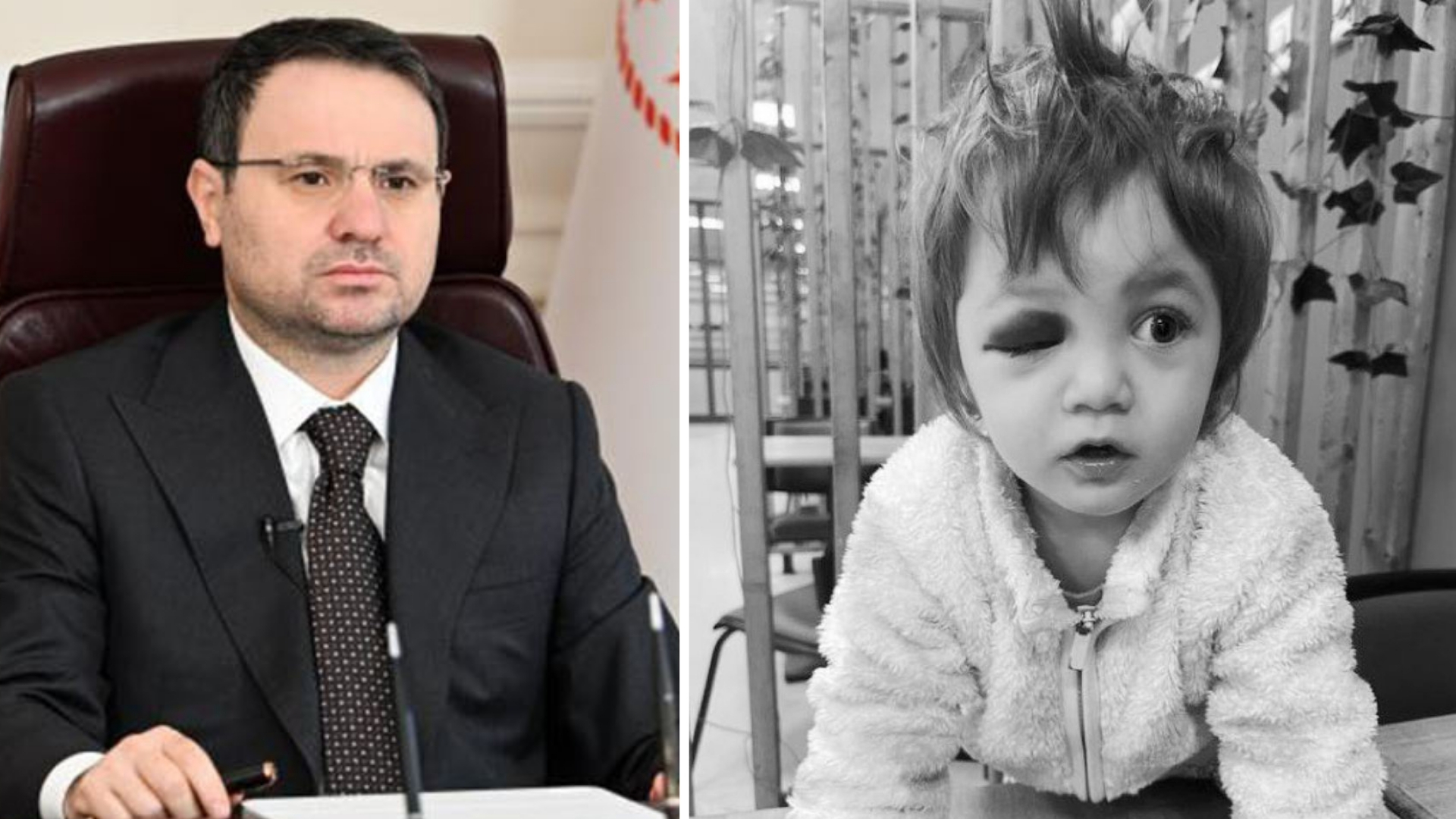 Yalova’da kucağındaki bebeğiyle birlikte saldırıya uğrayan baba ve 14 aylık