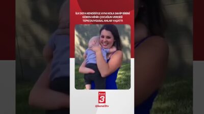 İlk defa kendisiyle aynı kola sahip birini gören minik çocuğun