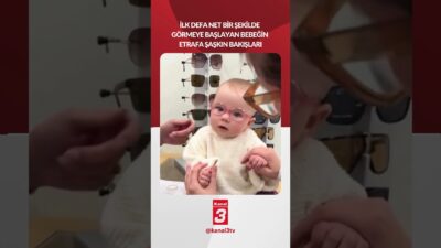 Gözleri bozuk olan bir bebek gözlük taktıktan sonra etrafı çok