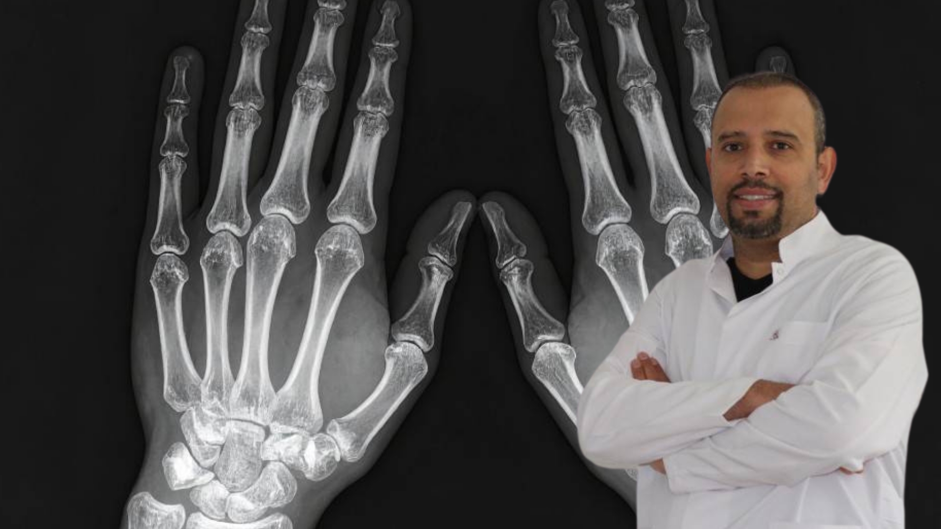 AFSÜ Tıp Fakültesi İç Hastalıkları Ana Bilim Dalı, Romatoloji Bilim