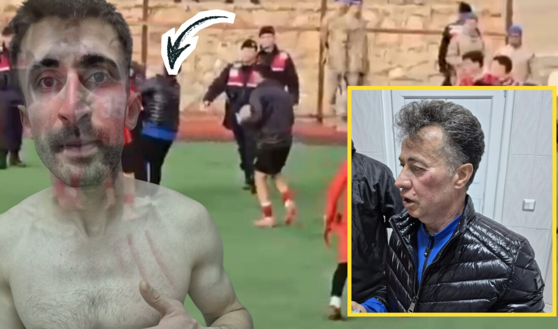 Afyonkarahisar Süper Amatör Lig’de şampiyonluk yolundaki kritik maçta kan aktı.