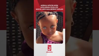 Afrikalı küçük kızın gözlerinin güzelliği sosyal medyada beğeni topladı! 📶https://kanal3.com.tr/