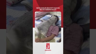 Nefes darlığı şikayeti yaşayan bir kişi sebebini buldu! 📶https://kanal3.com.tr/ Sosyal