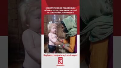 Hindistan’da esmer tenli bir ailede dünyaya gelen çocuk, beyaz teni