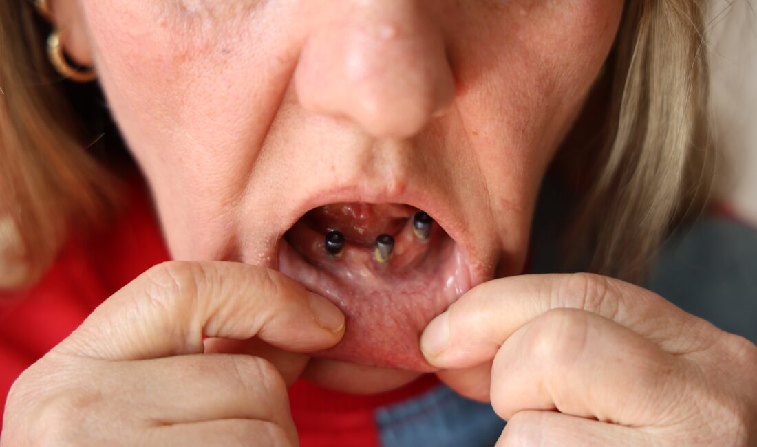 Sivas’ta yaşayan iki çocuk annesi Gülbeyaz Çelikdemir, diş ağrısı şikayetiyle