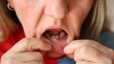 Sivas’ta yaşayan iki çocuk annesi Gülbeyaz Çelikdemir, diş ağrısı şikayetiyle