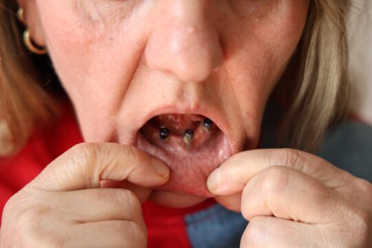 Sivas’ta yaşayan iki çocuk annesi Gülbeyaz Çelikdemir, diş ağrısı şikayetiyle