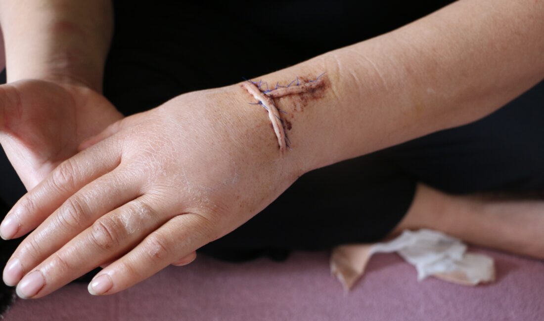 Diyarbakır, kan donduran bir kadına şiddet olayıyla sarsıldı. 16 yıllık