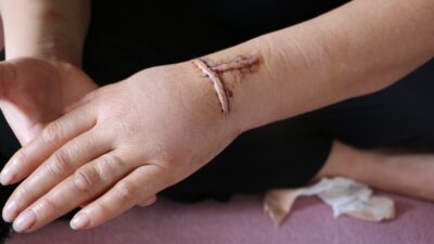 Diyarbakır, kan donduran bir kadına şiddet olayıyla sarsıldı. 16 yıllık