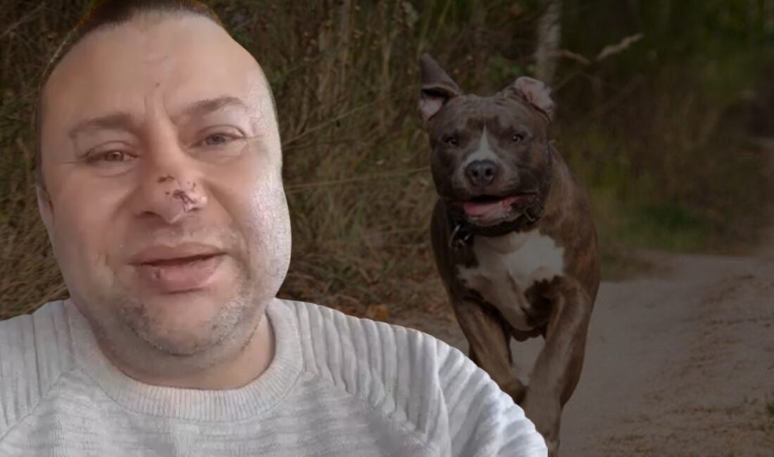 Balıkesir Akçay’da köpeğini gezdirdiği sırada Pitbull cinsi bir köpeğin saldırısına