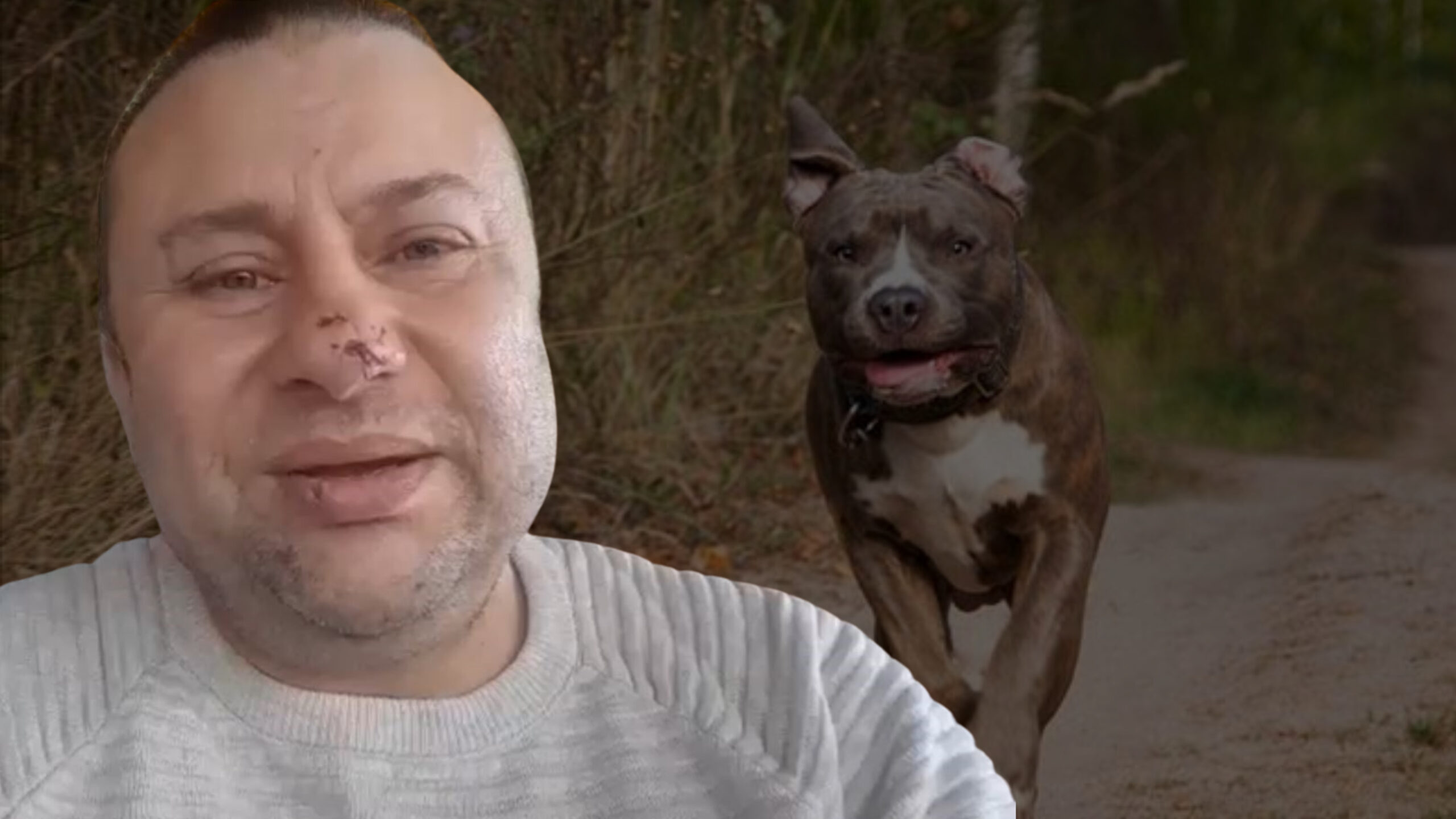 Balıkesir Akçay’da köpeğini gezdirdiği sırada Pitbull cinsi bir köpeğin saldırısına