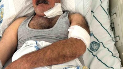 Diyarbakır’ın Sur ilçesinde, yıllardır özenle baktığı atının saldırısına uğrayan bir