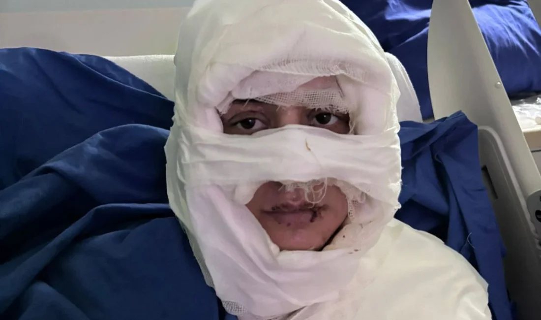 İstanbul Kadıköy'de bir eğlence mekanında oturan Gözde Yılmaz'ın üzerine kolonya