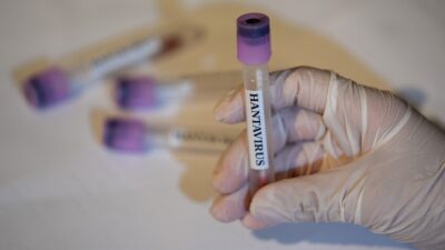 İsrail'de, birkaç ay önce Doğu Avrupa'da kaldığı sırada enfekte olduğu