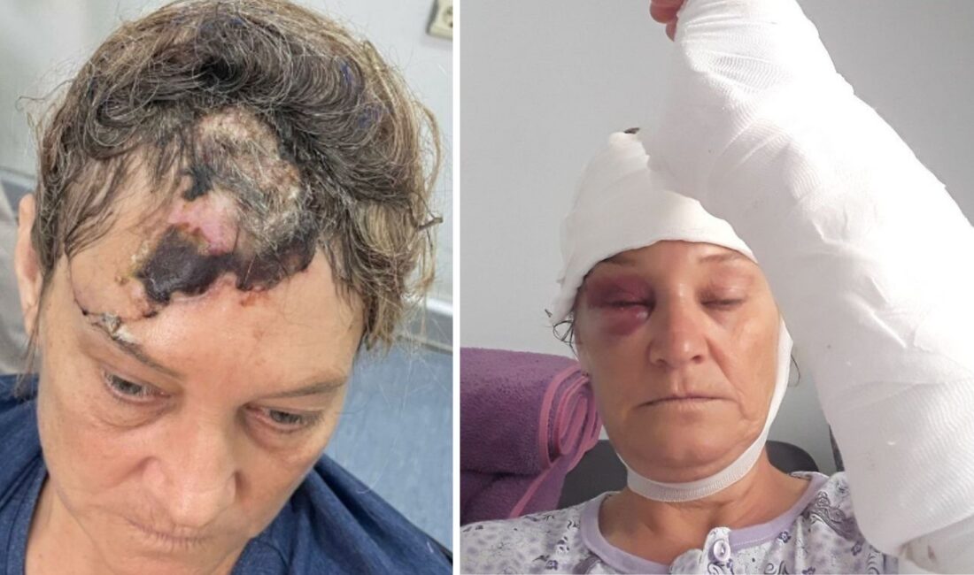 İzmir'in Bornova ilçesinde, patronuna ait Amerikan Akita cinsi köpeğin vahşi