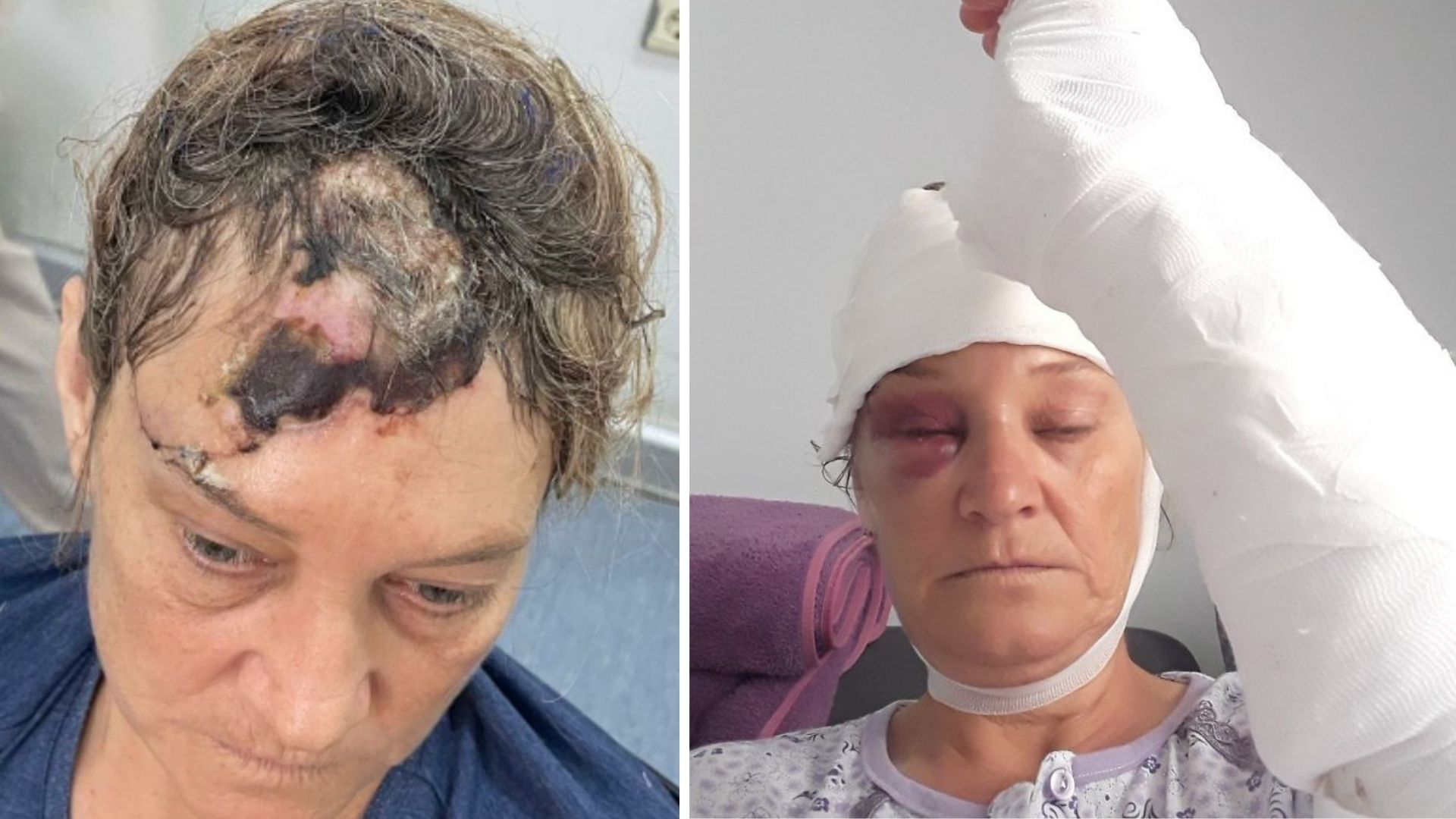 İzmir'in Bornova ilçesinde, patronuna ait Amerikan Akita cinsi köpeğin vahşi