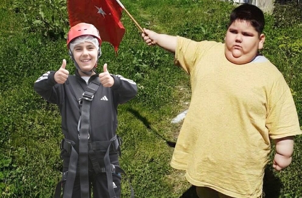 Samsun'da doğuştan leptin hormonu eksikliği nedeniyle tokluk hissi oluşmayan ve