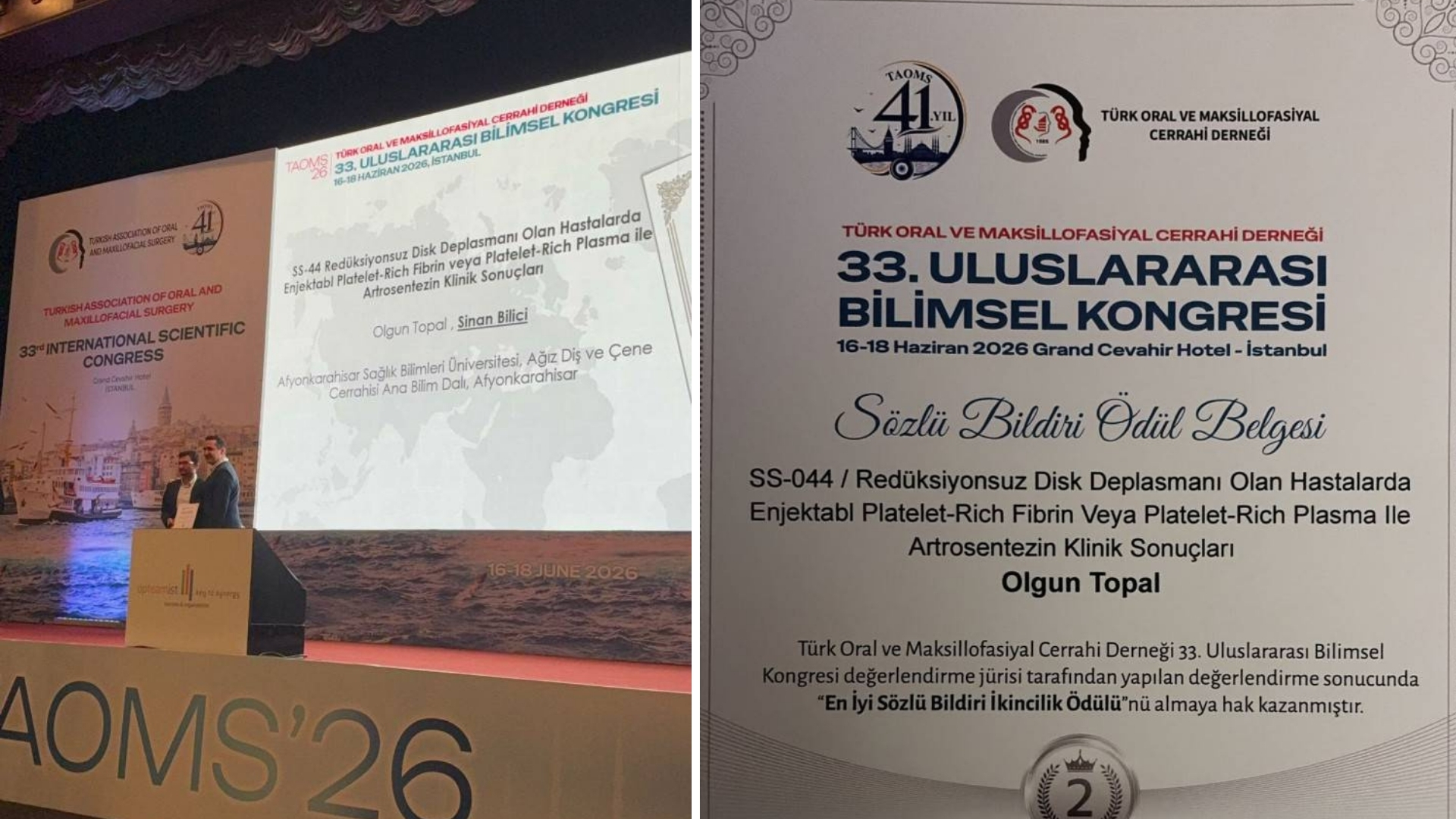AFSÜ Diş Hekimliği Fakültesi (DHF) Ağız, Diş ve Çene Cerrahisi