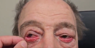 Göz sağlığı ve cerrahisi alanında tanınan Prof. Dr. Levent Akçay,