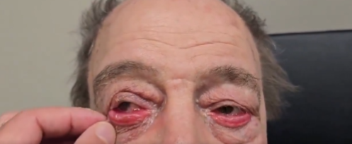 Göz sağlığı ve cerrahisi alanında tanınan Prof. Dr. Levent Akçay,